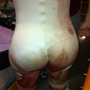 Same day of Surgery