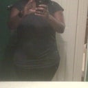 9 weeks Post Op Clothed