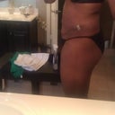 5 weeks PO, side view (right)