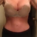 5 months post op