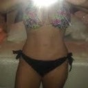 5 months post op