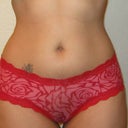 Before the surgery - underwear