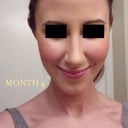 Month 4