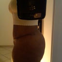 14 days after vaser lipo