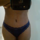 14 days after vaser lipo