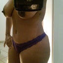 14 days after vaser lipo