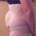Before - Side. I can't wait to get rid of this buldge and get my belly back.