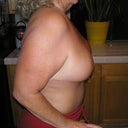 all most a year since surgery