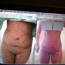 before surgery, and 3 days post op