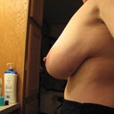 Before: Lateral view of left breast.  I'm a little twisted here, but you get the point