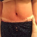 PO Day 3. Still swollen.