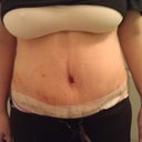 PO Day 9