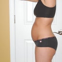 Left Side - Before on 03/06/2011