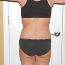 Back - Before on 03/06/2011