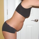 Right Side, Bent Over - Before on 03/06/2011