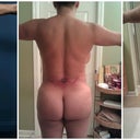 1st pic is before bbl, 2nd pic is a year after 1st bbl and 3rd pic is a day after 2nd bbl.