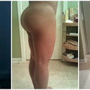 1st pic is before bbl, 2nd pic is a year after 1st bbl and 3rd pic is a day after 2nd bbl.