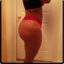 Side 7 months post-op