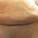 Close up of c-section area