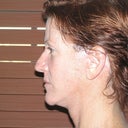 Side view, after