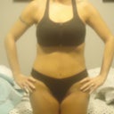PO 6 days REVISION lipo.fat transfer to butt - front....it hurts just looking at these...swelling, PLEASE go away quickly?!