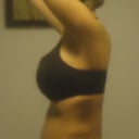 PO REVISION side view - note lower back.....PUFFY & crazy swollen. Ahhh the things we do for beauty,,,