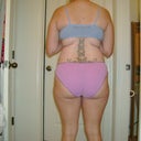 upper back fat and saddle bags