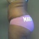 Before side pics...