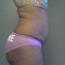 Fat back please be gone