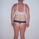 Back view morning of surgery