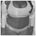 6 days post op