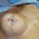 Pic the doc took of me