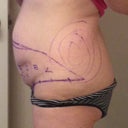 Right side- the circles are where the lipo is going to be