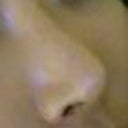 After the third and final surgery to correct the rest and lift the tip of the nose.
