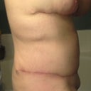 6.5 weeks PO