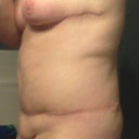 6.5 weeks PO