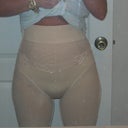 2 days post op with lovely girdle.