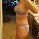 3 weeks/still have swelling