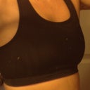 The day after removal, looks so flat, but feels awesome :)