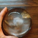 The implant removed