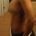 Day 2 after side shot