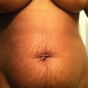 2 days before surgery