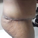 side view standing still swollen