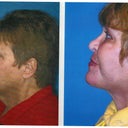 side view of neck and jawline.
