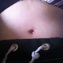 My BB 7 weeks PO. Looks better in person.