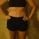 Around 10 weeks post OP