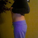 one month 5 days post op.