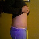 much less swelling above the scar, whew!