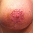 29 day close up right