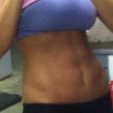 almost 2 years later and I couldnt be happier with my mini tummy tuck